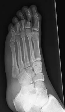 General Orthopedics 2026 Practice Questions: Set 19 (Solved) - Figure 15