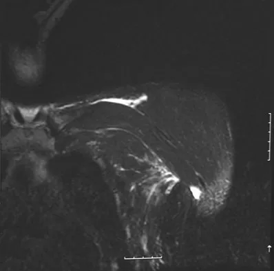 General Orthopedics 2026 Practice Questions: Set 19 (Solved) - Figure 17