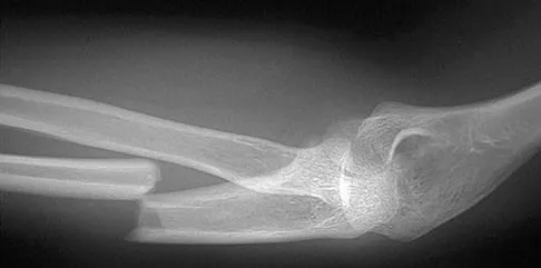 General Orthopedics 2026 Practice Questions: Set 19 (Solved) - Figure 2