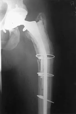 General Orthopedics 2026 Practice Questions: Set 19 (Solved) - Figure 21