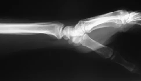 General Orthopedics 2026 Practice Questions: Set 19 (Solved) - Figure 26