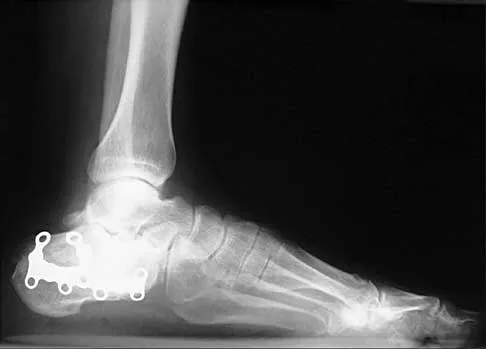 General Orthopedics 2026 Practice Questions: Set 19 (Solved) - Figure 36