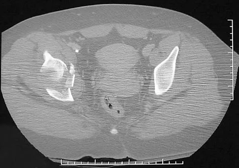 General Orthopedics 2026 Practice Questions: Set 19 (Solved) - Figure 38