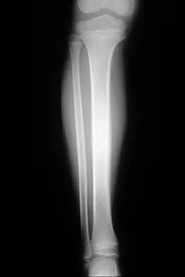 General Orthopedics 2026 Practice Questions: Set 19 (Solved) - Figure 45