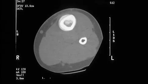 General Orthopedics 2026 Practice Questions: Set 19 (Solved) - Figure 47