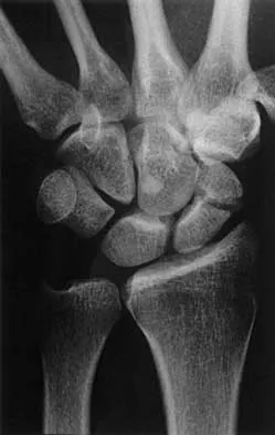 General Orthopedics 2026 Practice Questions: Set 19 (Solved) - Figure 59