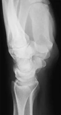 General Orthopedics 2026 Practice Questions: Set 19 (Solved) - Figure 6