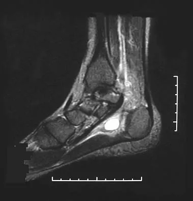 General Orthopedics 2026 Practice Questions: Set 19 (Solved) - Figure 64