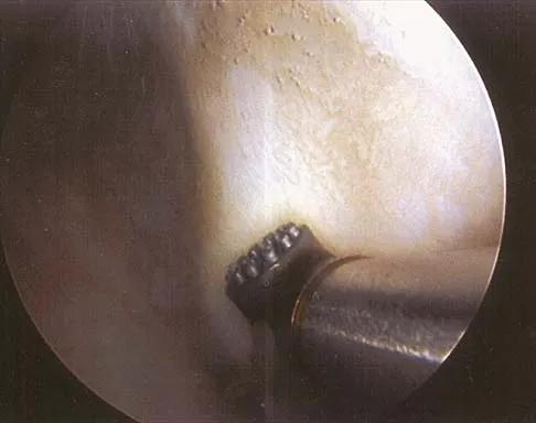 General Orthopedics 2026 Practice Questions: Set 19 (Solved) - Figure 66