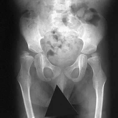 General Orthopedics 2026 Practice Questions: Set 19 (Solved) - Figure 70
