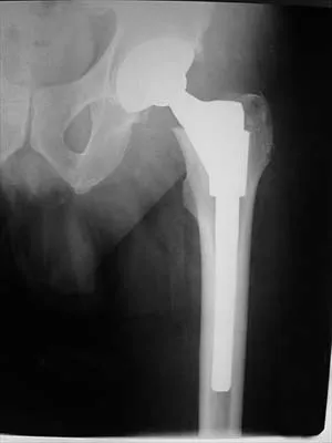 General Orthopedics 2026 Practice Questions: Set 19 (Solved) - Figure 71