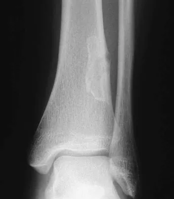 General Orthopedics 2026 Practice Questions: Set 19 (Solved) - Figure 80