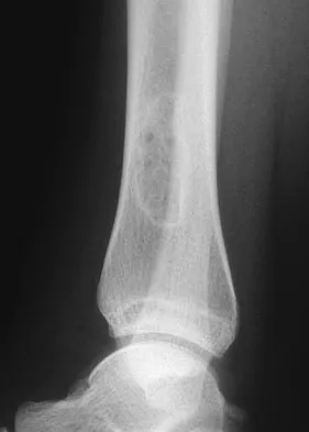 General Orthopedics 2026 Practice Questions: Set 19 (Solved) - Figure 81