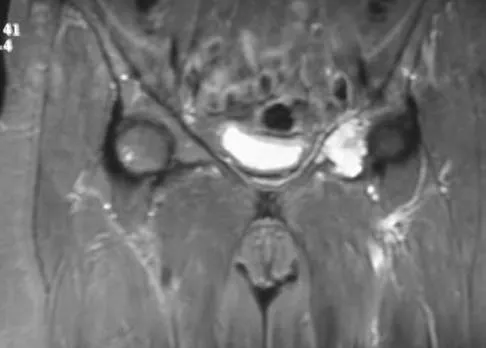 General Orthopedics 2026 Practice Questions: Set 19 (Solved) - Figure 84