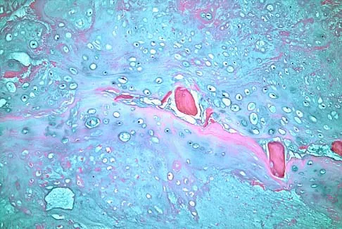 General Orthopedics 2026 Practice Questions: Set 19 (Solved) - Figure 85