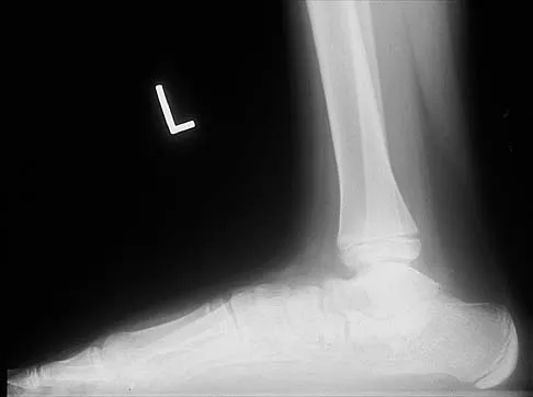 General Orthopedics 2026 Practice Questions: Set 19 (Solved) - Figure 88