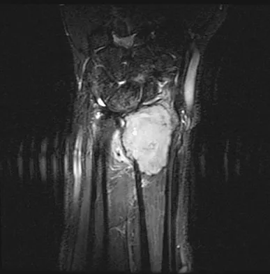 General Orthopedics Board Review 2026: High-Yield MCQs (Set 2) - Figure 100