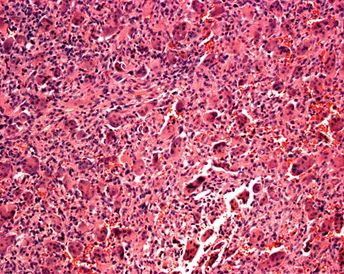 General Orthopedics Board Review 2026: High-Yield MCQs (Set 2) - Figure 101