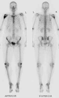 General Orthopedics Board Review 2026: High-Yield MCQs (Set 2) - Figure 109