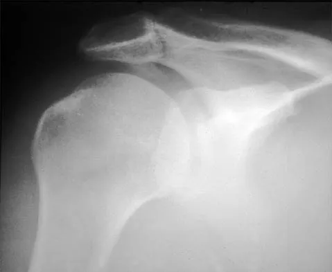 General Orthopedics Board Review 2026: High-Yield MCQs (Set 2) - Figure 11