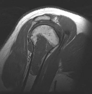 General Orthopedics Board Review 2026: High-Yield MCQs (Set 2) - Figure 110