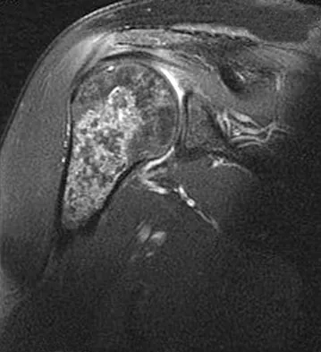 General Orthopedics Board Review 2026: High-Yield MCQs (Set 2) - Figure 112