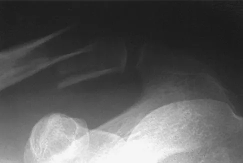 General Orthopedics Board Review 2026: High-Yield MCQs (Set 2) - Figure 116