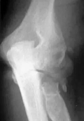 General Orthopedics Board Review 2026: High-Yield MCQs (Set 2) - Figure 119