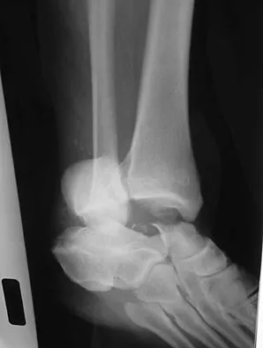 General Orthopedics Board Review 2026: High-Yield MCQs (Set 2) - Figure 121