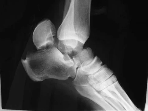 General Orthopedics Board Review 2026: High-Yield MCQs (Set 2) - Figure 123