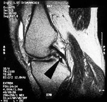 General Orthopedics Board Review 2026: High-Yield MCQs (Set 2) - Figure 126