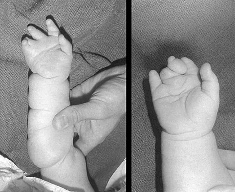 General Orthopedics Board Review 2026: High-Yield MCQs (Set 2) - Figure 127