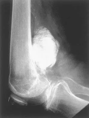 General Orthopedics Board Review 2026: High-Yield MCQs (Set 2) - Figure 128