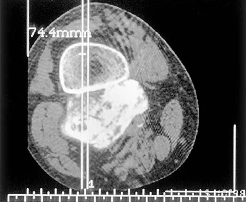 General Orthopedics Board Review 2026: High-Yield MCQs (Set 2) - Figure 129