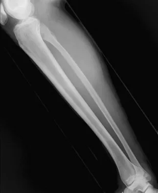 General Orthopedics Board Review 2026: High-Yield MCQs (Set 2) - Figure 131