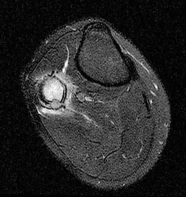 General Orthopedics Board Review 2026: High-Yield MCQs (Set 2) - Figure 134