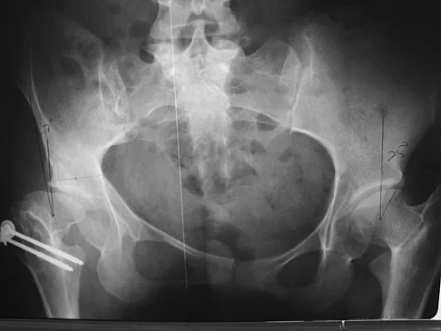 General Orthopedics Board Review 2026: High-Yield MCQs (Set 2) - Figure 136