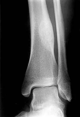 General Orthopedics Board Review 2026: High-Yield MCQs (Set 2) - Figure 140