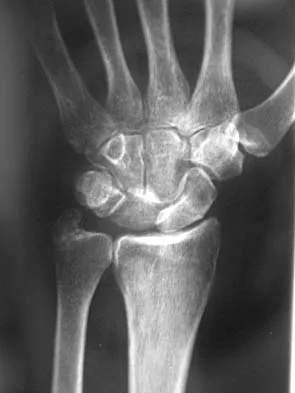 General Orthopedics Board Review 2026: High-Yield MCQs (Set 2) - Figure 16