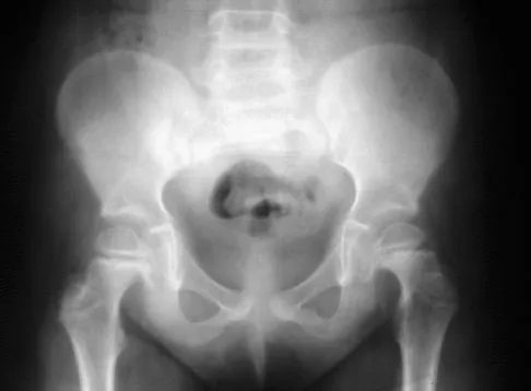 General Orthopedics Board Review 2026: High-Yield MCQs (Set 2) - Figure 21