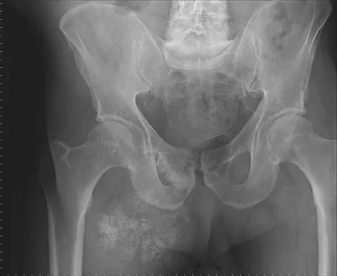 General Orthopedics Board Review 2026: High-Yield MCQs (Set 2) - Figure 30