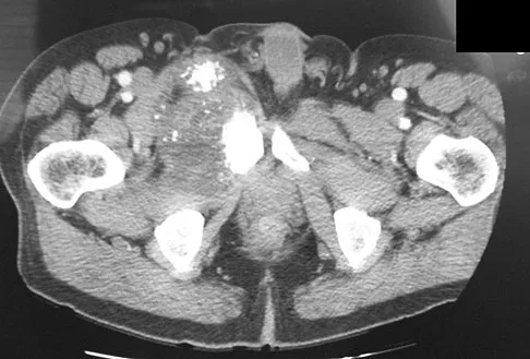 General Orthopedics Board Review 2026: High-Yield MCQs (Set 2) - Figure 31