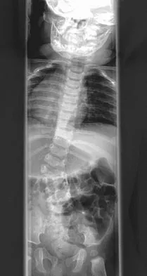 General Orthopedics Board Review 2026: High-Yield MCQs (Set 2) - Figure 33