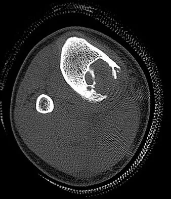 General Orthopedics Board Review 2026: High-Yield MCQs (Set 2) - Figure 40