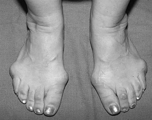 General Orthopedics Board Review 2026: High-Yield MCQs (Set 2) - Figure 41