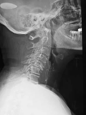 General Orthopedics Board Review 2026: High-Yield MCQs (Set 2) - Figure 46