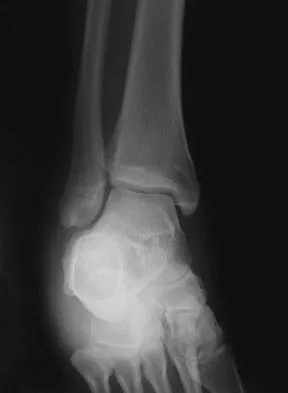 General Orthopedics Board Review 2026: High-Yield MCQs (Set 2) - Figure 50