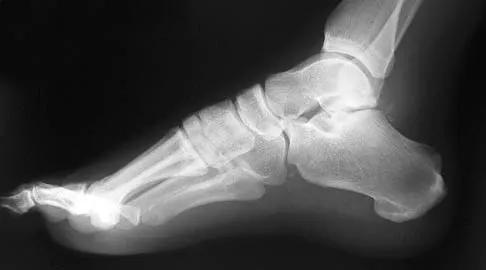 General Orthopedics Board Review 2026: High-Yield MCQs (Set 2) - Figure 51