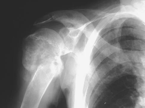 General Orthopedics Board Review 2026: High-Yield MCQs (Set 2) - Figure 58