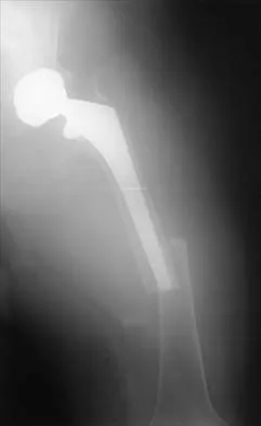 General Orthopedics Board Review 2026: High-Yield MCQs (Set 2) - Figure 59